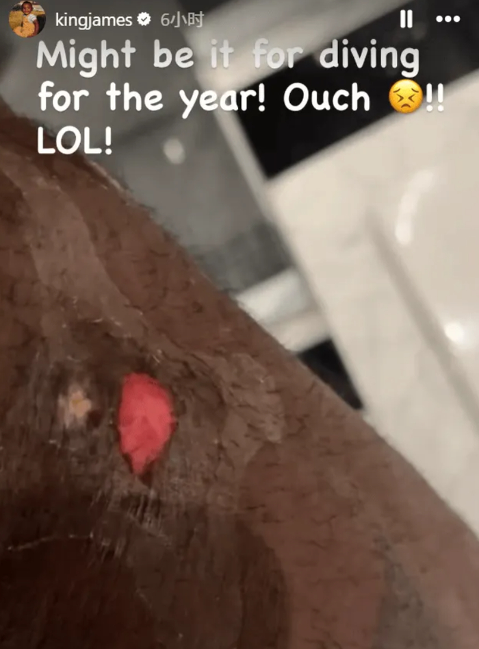 41岁勒布朗带伤狂砍18+5+5 领航湖人掀翻火箭